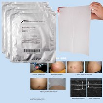 부동액 막 마스크 필름 지방 방지 냉각 젤 패드 크라이오 치료용 종이, 01 12x12 30g