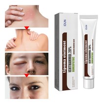 Idun 습진연고 피부 가려움증 피부건선 가려움증 20ml, 1개