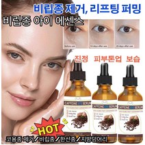 1+1 비립종 아이 에센스 비립종/한선종/지방덩어리 안티에이징 주름개선 에센스 아이 에센스 오일 아래 눈꺼풀 개선/주름 감소 30ml, 30ml*2