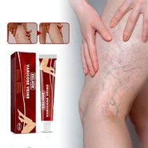 효과적인 허브 정맥류 완화 크림 혈관염 정맥염 거미 통증 연고 석고 뷰티 바디 케어, [02] Buy 80g Get 100g