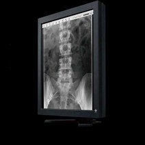의료용 모니터 수술용 고정밀 화면 X-ray 판독 치과, 20인치 의료용 모니터