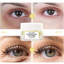 MSLAM 눈밑지방제거 눈밑꺼짐 눈밑주름 바나나 아이크림, 20ml, 1개