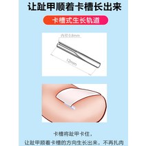 내성발톱교정기 정형용 패드 네일 그루브 임베디드 필링 손톱은 발톱 교정기 패치 염증을 교정하기 위해 육체 격리 패드에 찔려 있습니다., [10] 격리 패드 50개 + 손톱 제거제 + 손톱 가