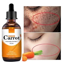 당근 에센스 에센셜 오일 다크 스팟 교정기 얼굴 미백 세럼 기미 주근깨 제거제 100% 내추럴, [01] 30ml