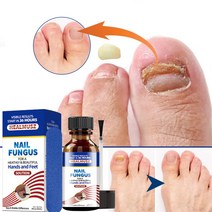 HEALMUSZ 발톱무좀치료 발톱무좀약 발톱무좀연고 발무좀연고 리페어 에센스, 2개, 30ml