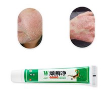kemisi 습진 스킨 러쉬 크림 피부염 습진 항균 연고 바디 초본 항균 크림, 1개