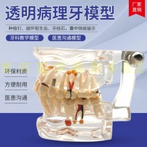 치아모형 인체모형도 치과기구 실리콘몰드 인체모형 양치교구 재료상 6배, 투명한 치아