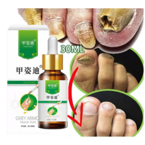 BT 발톱무좀 치료제 무좀약 무좀 케어제 발톱연화 무좀 관리, 2개, 30ml