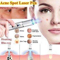 강남역피부과 같은 효과 기미 주름제거 색소치료 홍조에 좋은 화이트닝기계 LED페이셜마스크, 없음