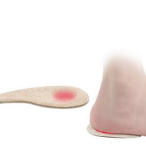 오다리 교정 깔창 휜다리 안짱다리 패드 쿠션 발바닥, 상품선택, 투명, 1개