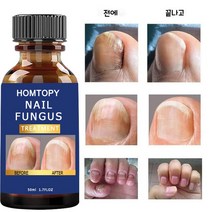 고고윙 무좀약 발톱무좀 조갑사상균증 치료 발무좀연고, 50ml