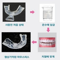 형상기억 이갈이 방지 마우스피스 수면용 장치 잠잘때 이악물기 이빨 갈기