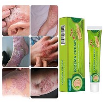 BT 피부 가려움증 연고 모낭염 두피 습진 건선연고 지루성피부염 치료, 5개, 20g