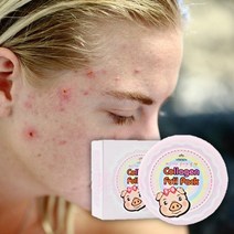 바르는콜라겐팩 100ml 2개 안면홍조 좁쌀 여드름 에좋은 팩 붉은기진정 얼굴 울긋불긋