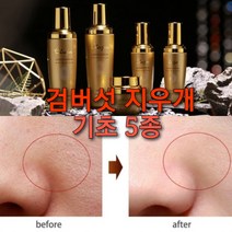 주름 잡티제거 기초 5종세트+줄기세포 마스크팩 10매/고흡수 아데노신 기능성 한방케어/기능성 스킨케어, 주름 잡티제거 엘루 기초5종
