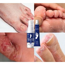 BT 무좀약 스프레이 발톱무좀 치료 발냄새 제거 발각질제거 발가려움 연고 30ML 15g, 2개, 1개