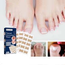 EELHOE 1+1+1 내성발톱교정기 염증통증완화 발톱꼬임 교정 패치, 1갑50pcs