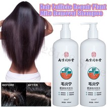 모발 염증 아미노산 닝 샴푸 주름 치료 모낭 식물 진드기 제거 헤어 크림 손상 회복 곱슬 머리 개선