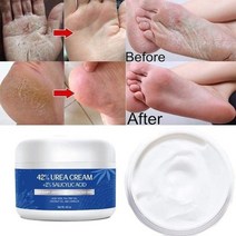 1+1 업그레이드된 굳은살 리무브제 건조한 갈라진 발 손 Urea 크림 42% Plus 살리실산 4 Oz, 04. 50G