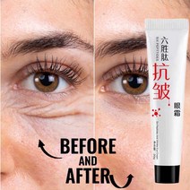 아이크림 바르는 콜라겐 영양 수분 크림 제거 백 안티 붓기 젤 다크 서클 지연 노화 페이드 주름 퍼밍 브라이트닝 스킨 화장품