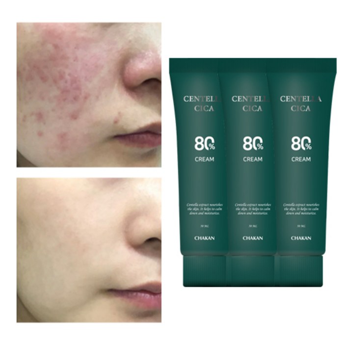 센텔라 시카 탄력 영양 보습 수분 병풀 크림, 3개, 50ml