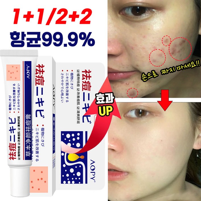 일본 1+1/2+2 여드름 흉터 제거 연고 피부 색소침착 미백 크림