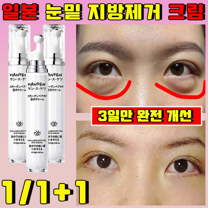 일본 눈밑 지방제거 아이 크림 아이팔트 아이백 리프팅 크림 주름개선 아이크림 다크서클 얼굴 주름 없애는 크림 변정수 아이백크림