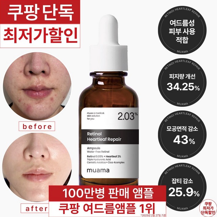 3일 여드름 재생진정 흉터 개선 앰플 100만병 판매기념 한정 할인 여드름 흉터  좁쌀 피지 개선 임상완료 레티놀 어성초 히알루론산 나이아신아마이드 뮤아마 앰플, 1개, 30ml