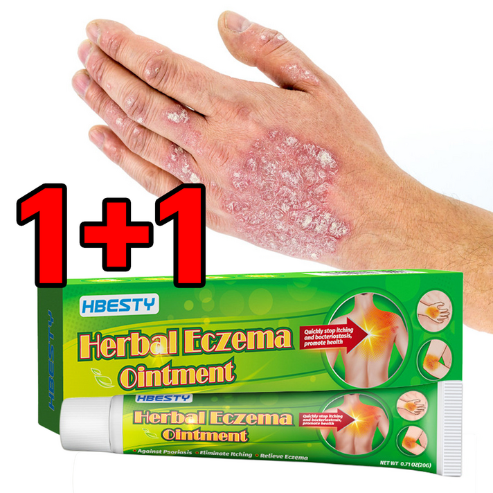 당일배송 11 피부건선 가려움증 습진연고 피부 가려움증