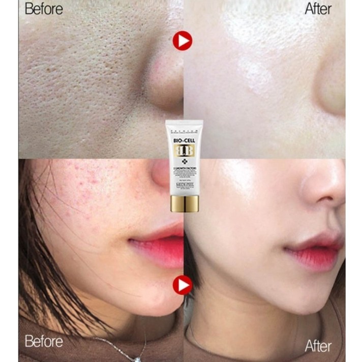 마테카 시카 회복BB회복 파운데이션레이져후에도 커버력up