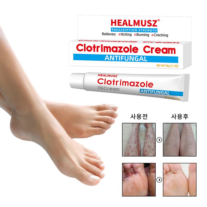 종합 허브크림 피부가려움증 항균 건선 습진 모낭염 연고, 30g, 2개 종합 허브크림 피부가려움증 항균 건선 습진 모낭염 연고, 30g, 2개