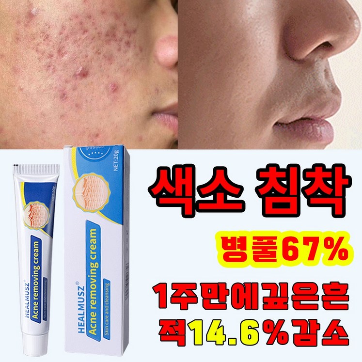 국내배송 병풀추출물 여드름 레티놀 여드름 연고 리페어 연고 진정 피지케어 크림 흉터 치료 자생 관리후 점뺀후 크림 발효 재생크림샤블 나이아신아마이드 레티놀 펩타이드크림, 1개, 20g